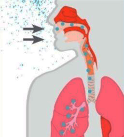 &lt;strong&gt;Figure 1.&lt;/strong&gt; Legionnaires&#x27; disease typically spreads through airborne water droplets that enter the airways and eventually land in the lungs. Figure courtesy of the Centers for Disease Control and Prevention.